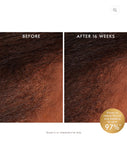Revitalizing Scalp Tonic