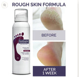 Rough Skin Formula