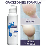 Cracked heel Formula