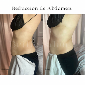 Reductos de Abdomen: 4 Secciones