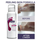 Peeling Skin Formula