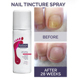Nail Tincture Spray